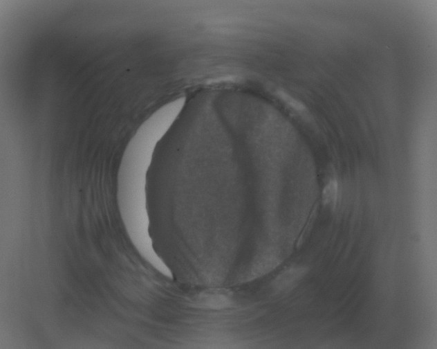 X0000081331156200702082155