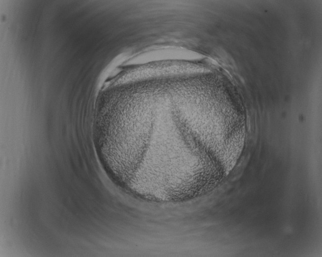 X0000081350003200702020126