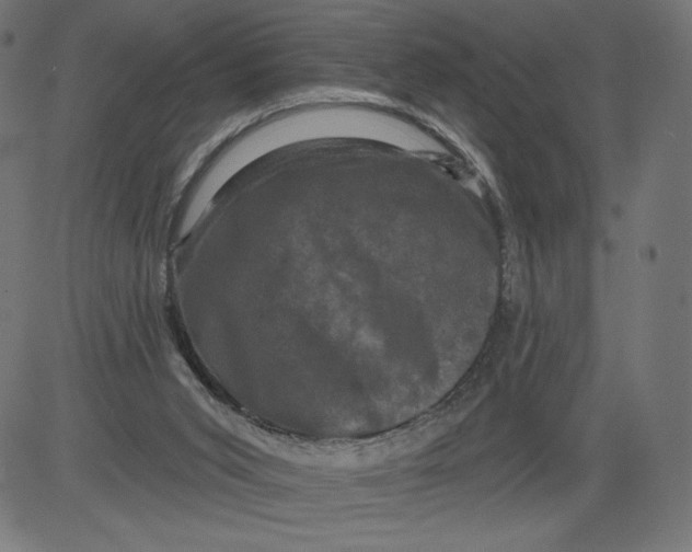 X0000081360015200702020151