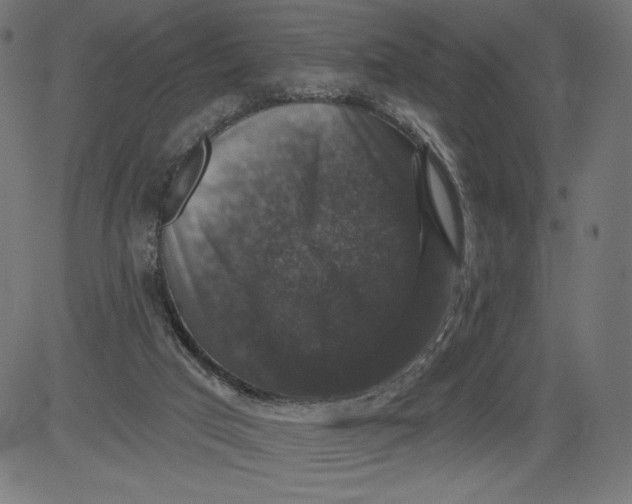 X0000081360017200702020151