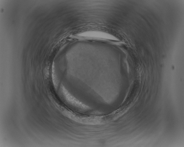 X0000081360032200702020151