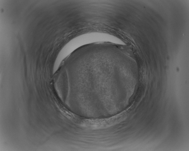 X0000081360033200702020151