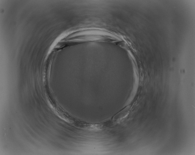 X0000081360056200702020150