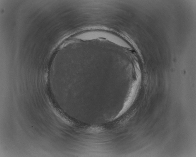 X0000081360063200702020150