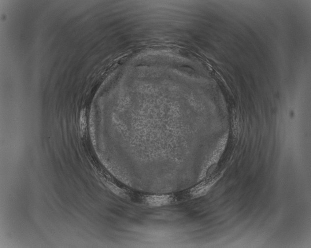 X0000081360085200702020151