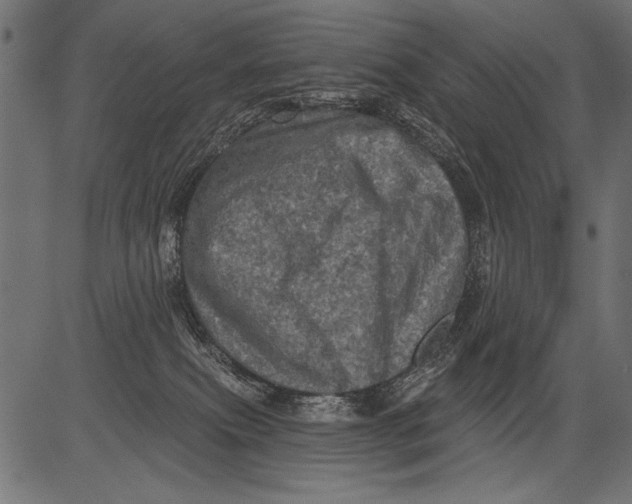 X0000081360087200702020151