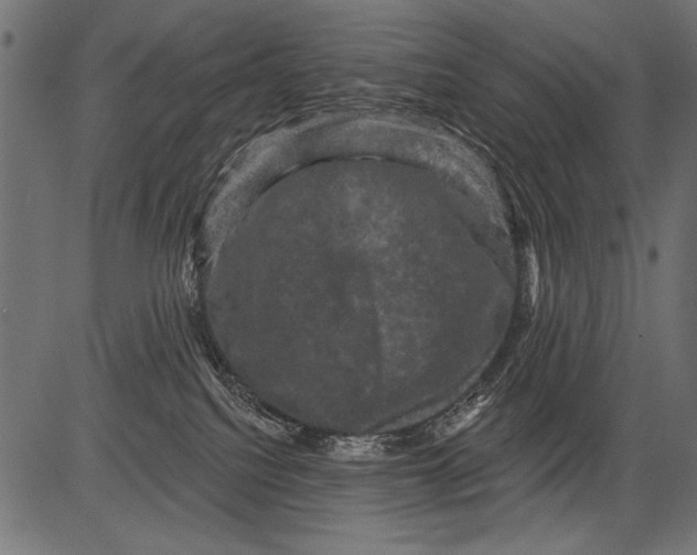 X0000081360088200702020151