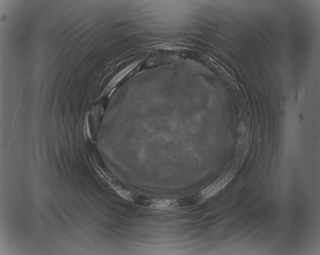 X0000081360096200702020151