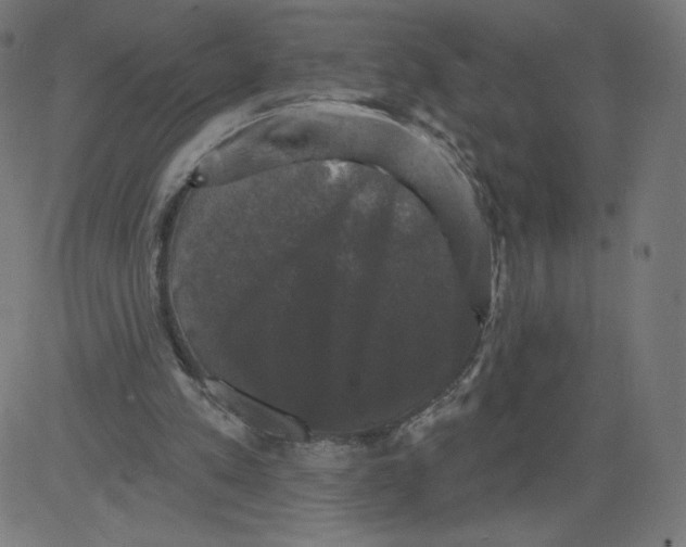 X0000081360197200702020148