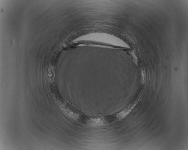 X0000081360237200702020148