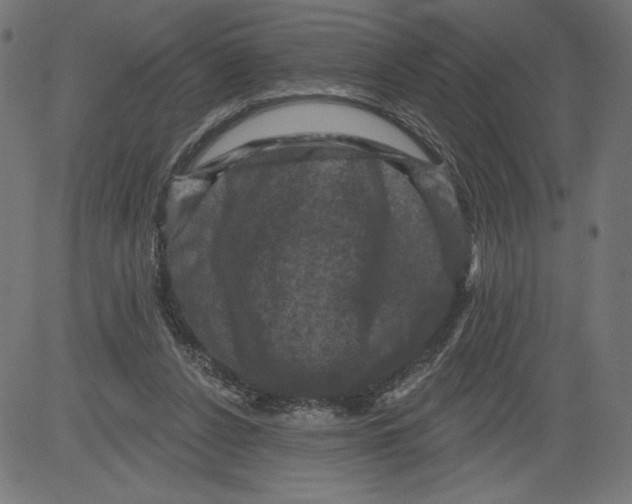 X0000081360256200702020147