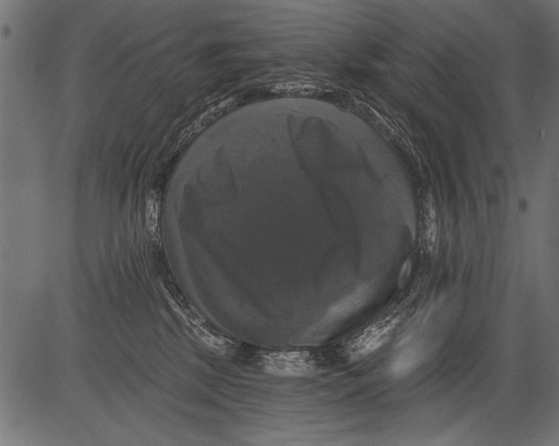 X0000081360281200702020148