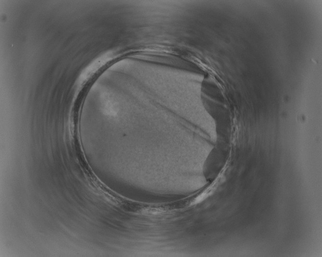 X0000081360294200702020147