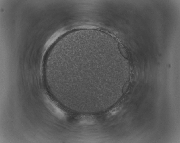 X0000081360296200702020147