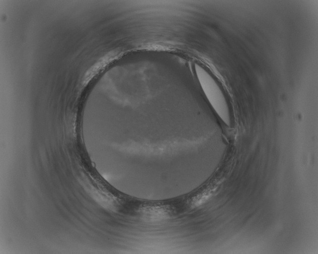 X0000081360299200702020147