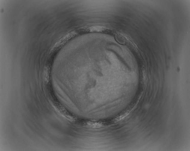 X0000081360311200702020147