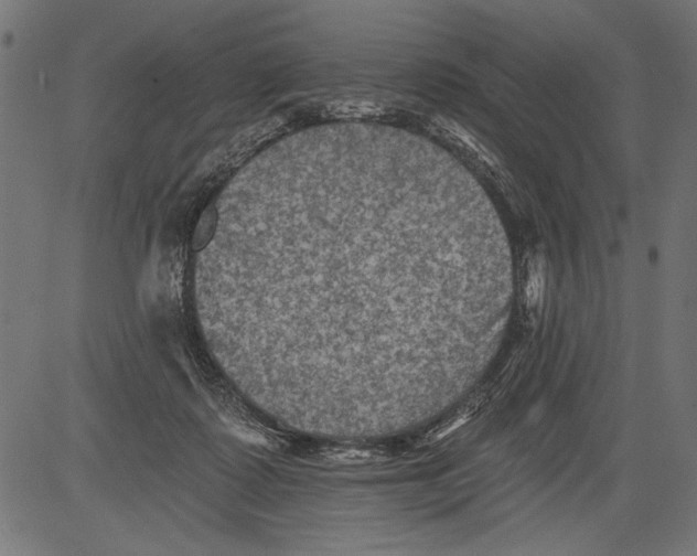 X0000081360315200702020146