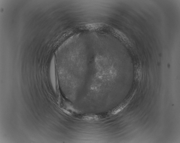 X0000081360317200702020146