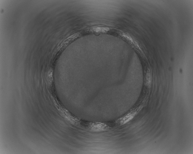 X0000081360321200702020146