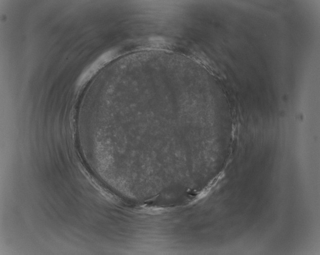 X0000081360341200702020145