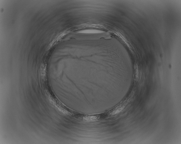 X0000081360357200702020146