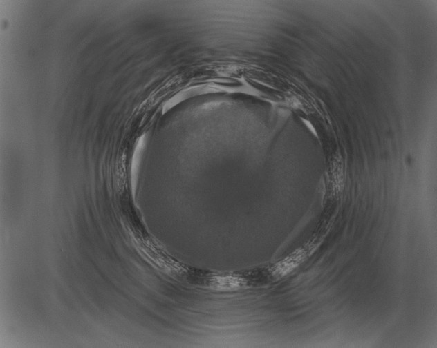 X0000081360376200702020146