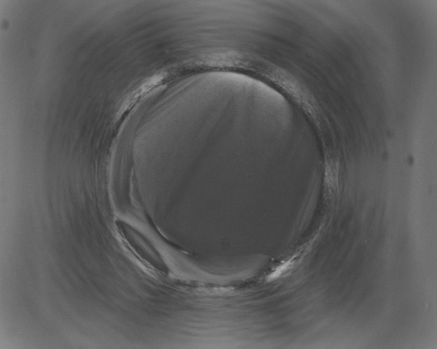 X0000081360397200702020145