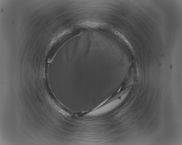 X0000081360399200702020145