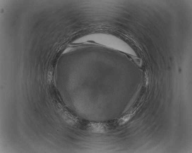 X0000081360417200702020145