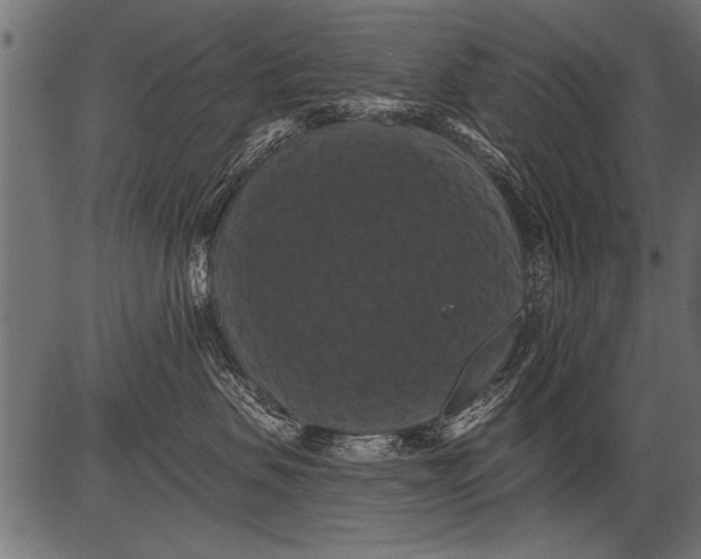 X0000081360479200702020145