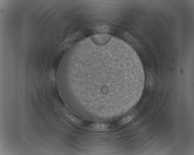 X0000081360518200702020143