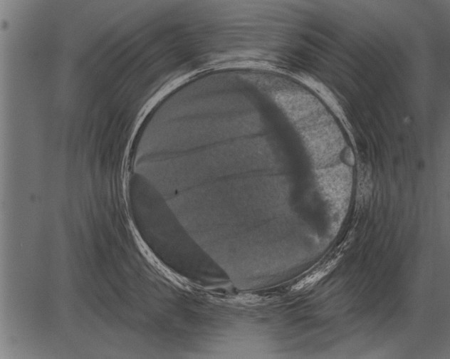 X0000081360957200702020137