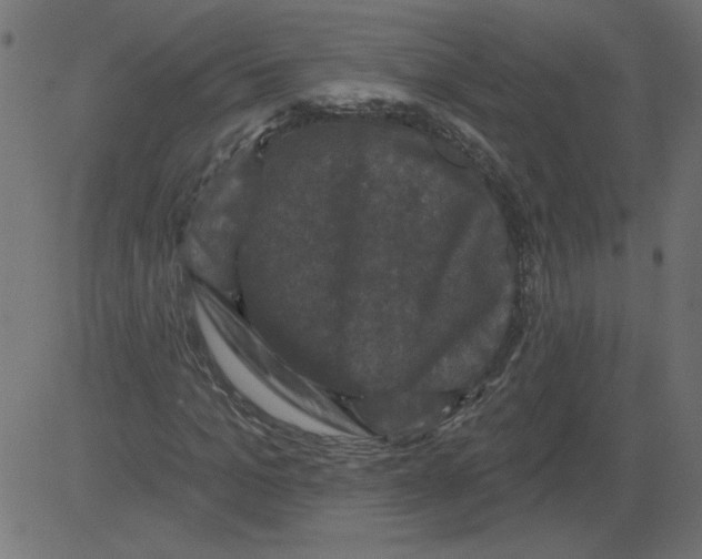 X0000081360965200702020136