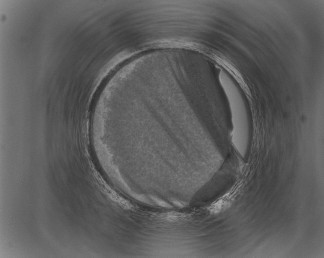 X0000081360992200702020135