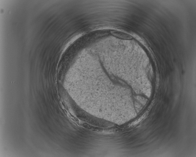 X0000081361145200702020133