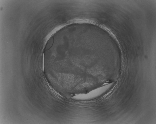 X0000081361175200702020132