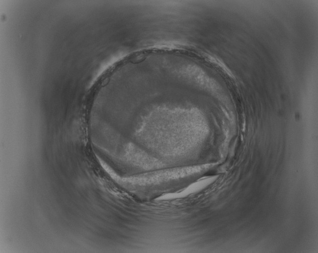 X0000081361256200702020131