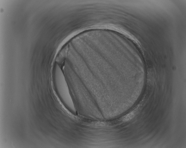 X0000081361517200702020127