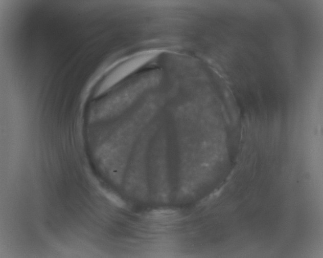 X0000081360150200702082329
