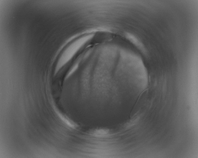 X0000081360156200702082329