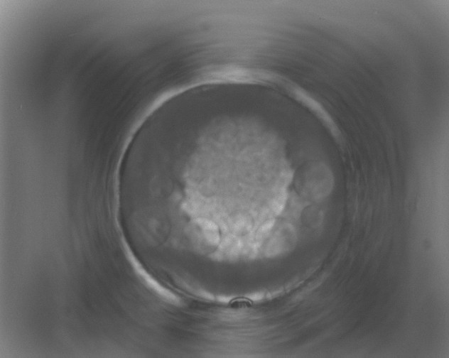 X0000081361479200702082307