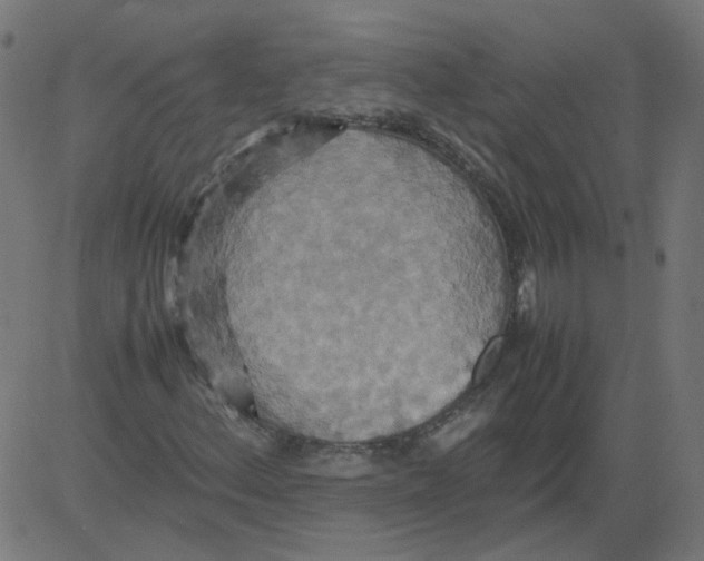 X0000081371156200702020158