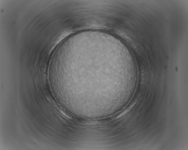 X0000081371170200702020158