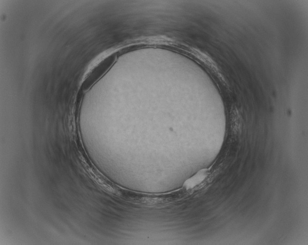 X0000081371176200702020158