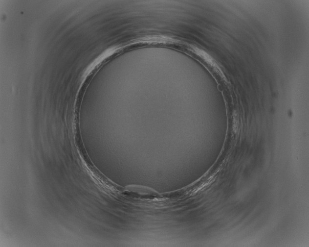 X0000081371229200702020157