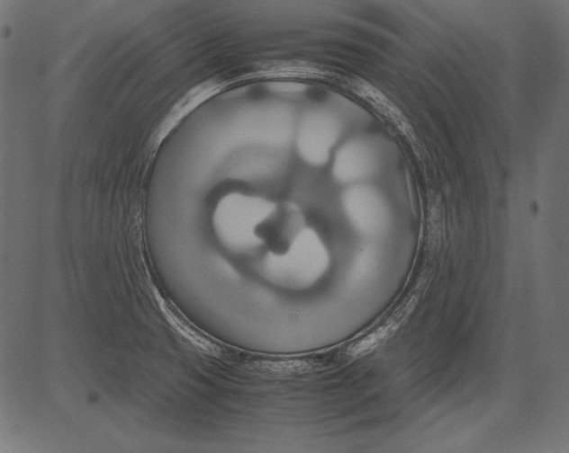 X0000081371425200702020154