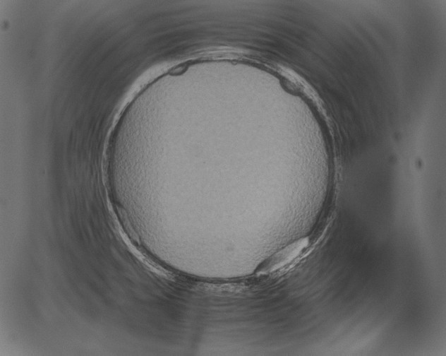 X0000081371429200702020154