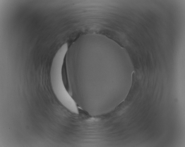 X0000081370818200702082344