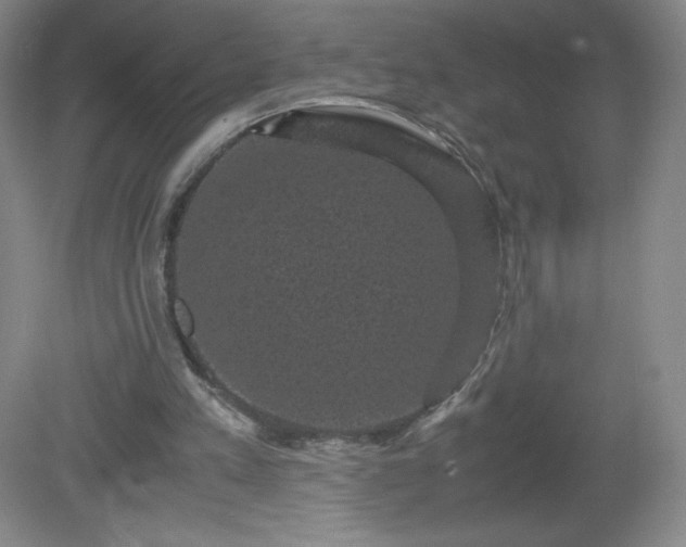 X0000081390197200701182241