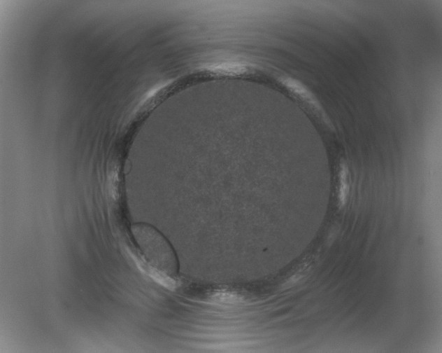 X0000081390596200701182234